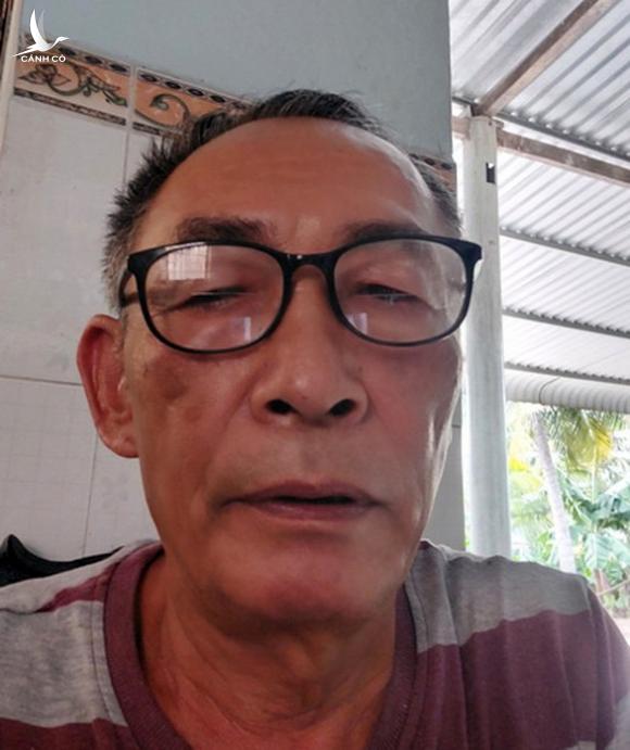 Cử tri Đồng Nai muốn làm rõ vụ ông Phạm Văn Sáng bỏ trốn Cử tri Đồng Nai muốn làm rõ vụ ông Phạm Văn Sáng bỏ trốn