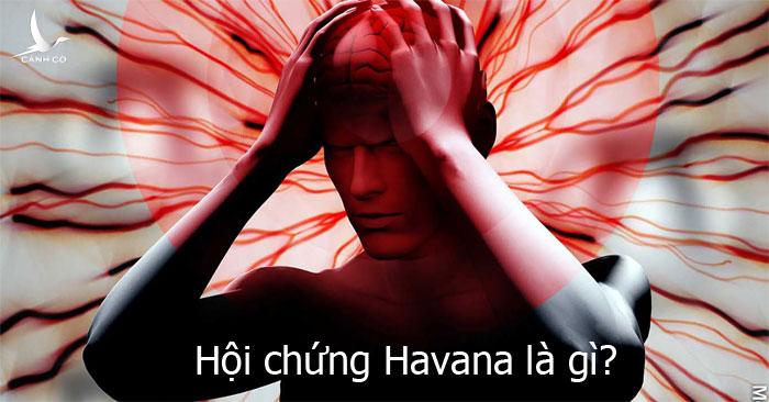 Hội chứng Havana – bí ẩn chưa lời đáp khiến CIA phải vào cuộc