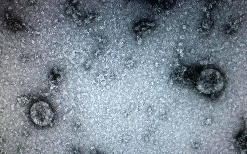 Việt Nam nuôi cấy và phân lập thành công virus corona mới (nCoV