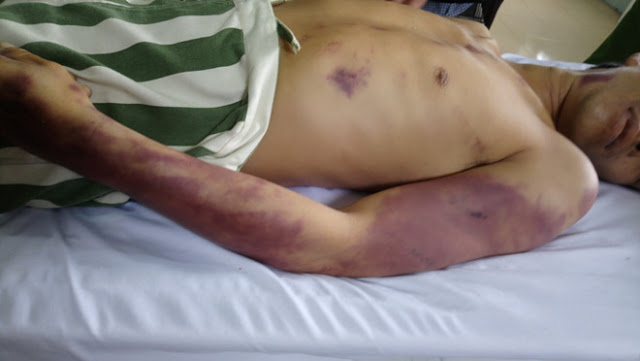 Báo cáo VKSNDTC vụ phạm nhân bị đánh chết ở huyện Châu Đức Báo cáo VKSNDTC vụ phạm nhân bị đánh chết ở huyện Châu Đức