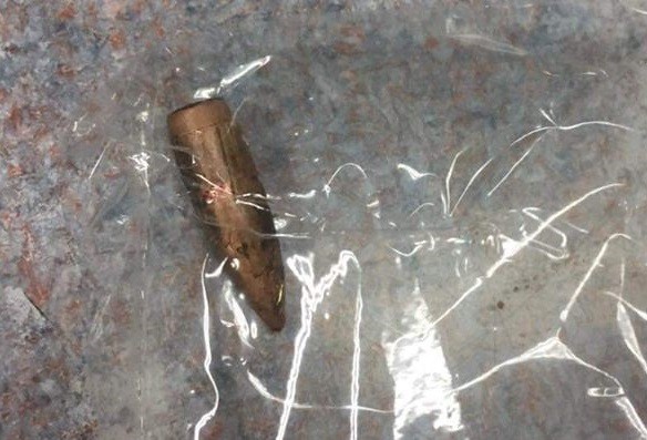 Đạn lạc gần trường bắn găm trúng đùi người dân Đạn lạc gần trường bắn găm trúng đùi người dân