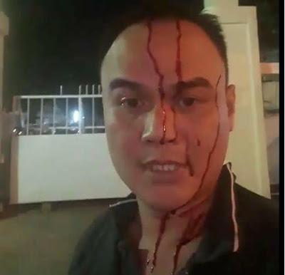 Huỳnh Quốc Huy dàn dựng “hiện trường” trước cổng biên phòng quân đội Huỳnh Quốc Huy dàn dựng “hiện trường” trước cổng biên phòng quân đội