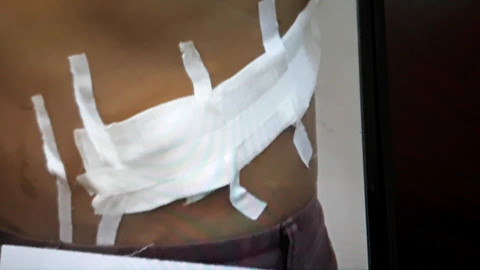 Cục CSHS Bộ Công an vừa triệt phá đường dây cực lớn buôn bán nội tạng người Cục CSHS Bộ Công an vừa triệt phá đường dây cực lớn buôn bán nội tạng người