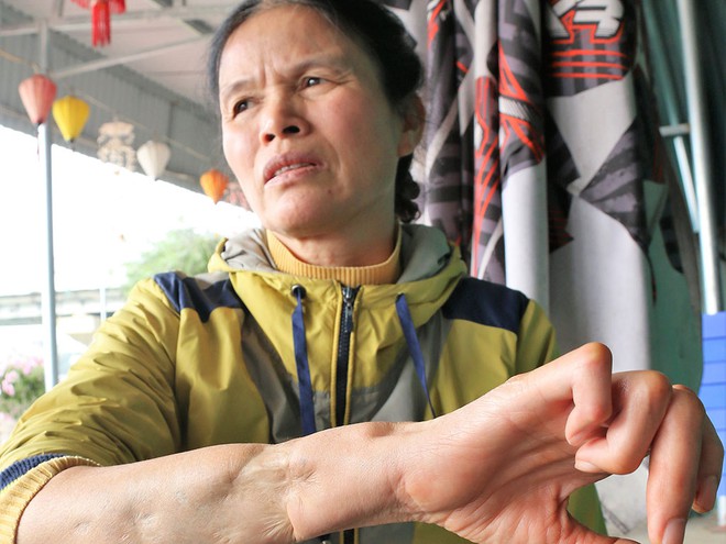 40 năm cuộc chiến đấu bảo vệ biên giới phía Bắc: Thảm sát trên hang Ngườm Hẩu