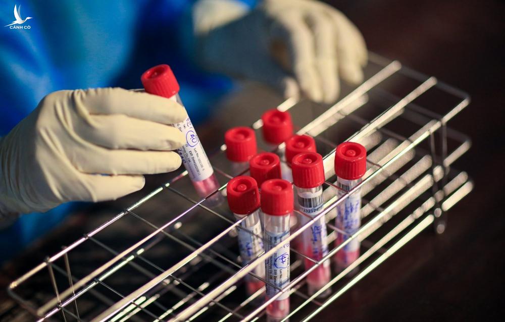 TP.HCM có thể thêm 10.000 ca mắc Covid-19 trong 5 ngày tới TP.HCM có thể thêm 10.000 ca mắc Covid-19 trong 5 ngày tới